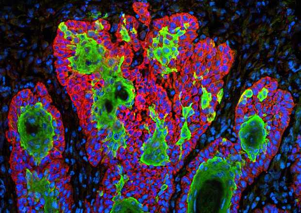Tumori: una antica proteina svela le funzioni del microRNA