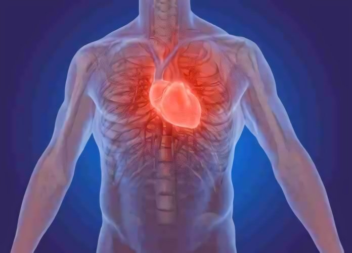 Infarto: il rischio è scritto nel sangue | Medicina