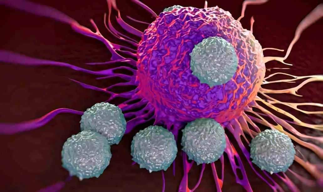 Diagnosi del cancro: una possibilità grazie ai microbi | Medicina