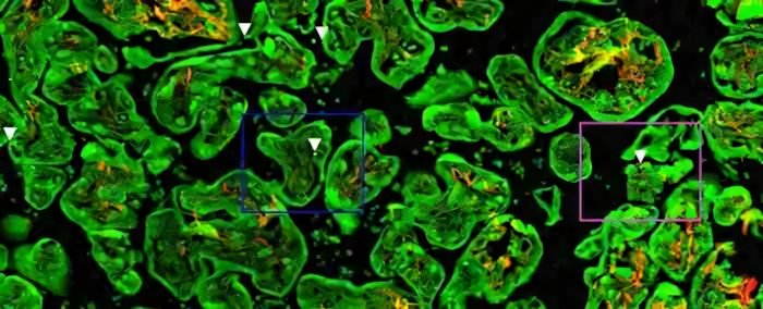 Combustibili fossili: lasciano il segno nella placenta | Biologia