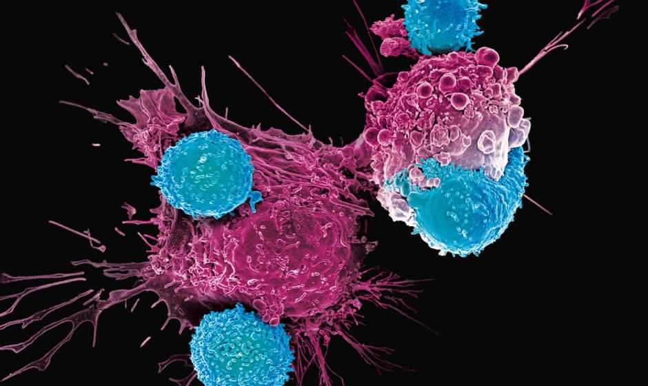 Cura tumore: testata per la prima volta la CRISPR | Medicina