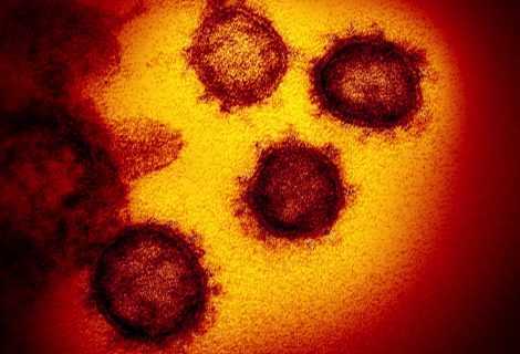 Coronavirus: ripercussioni sui cinema, tra rimborsi e cancellazioni