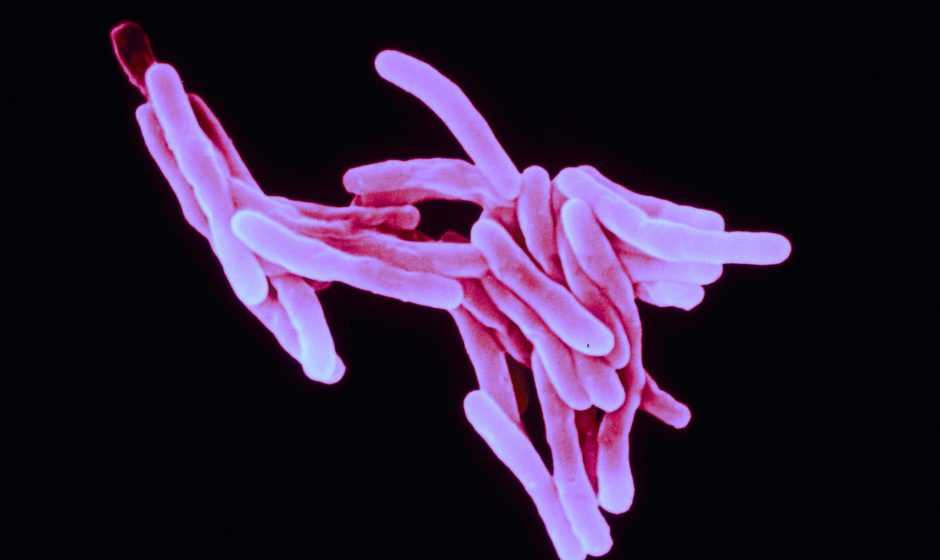 Antibiotico-resistenza: la tubercolosi muta | Medicina