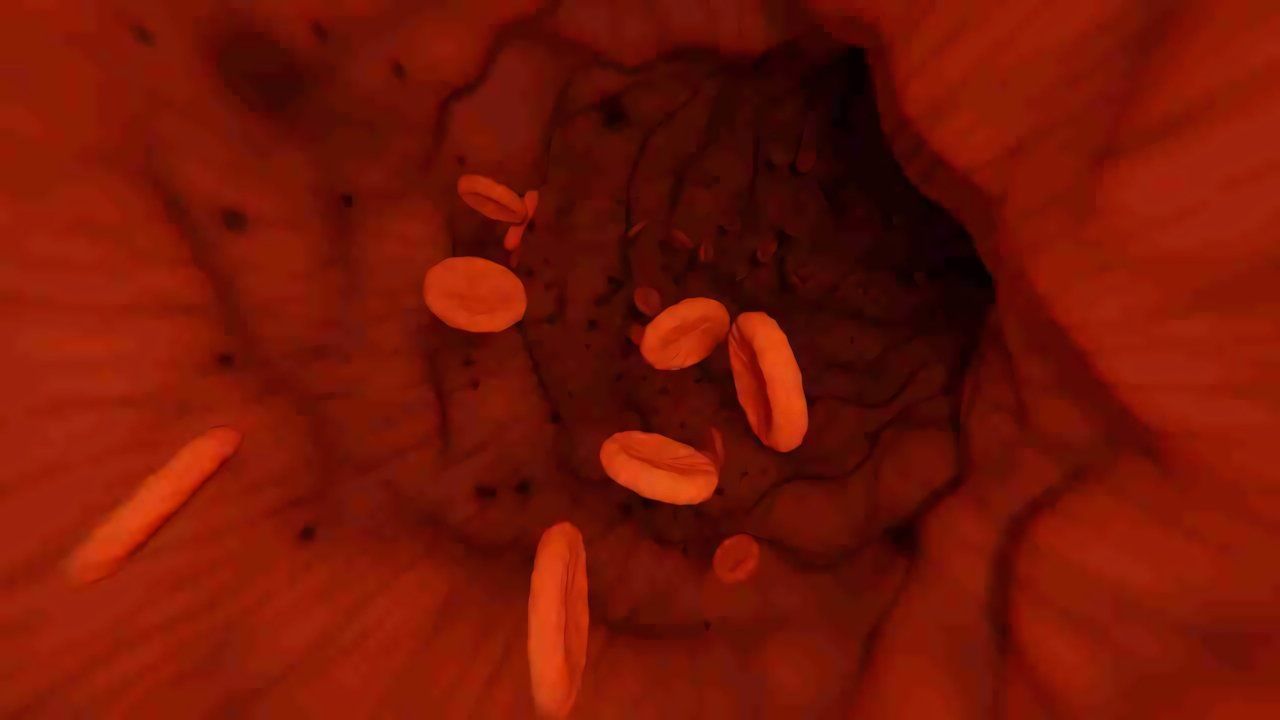 Diagnosi del cancro: una possibilità grazie ai microbi | Medicina