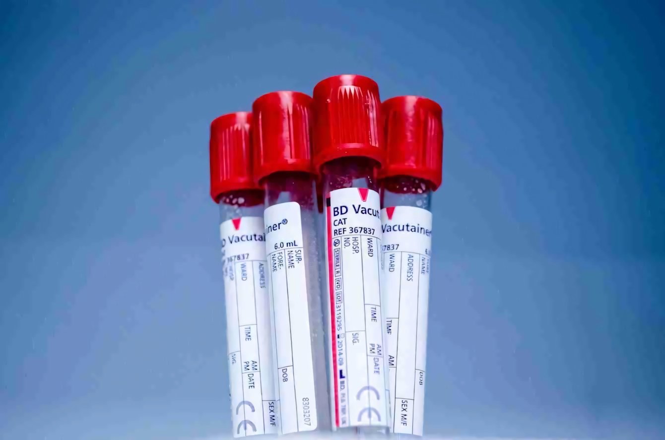 Diagnosi del cancro: una possibilità grazie ai microbi | Medicina