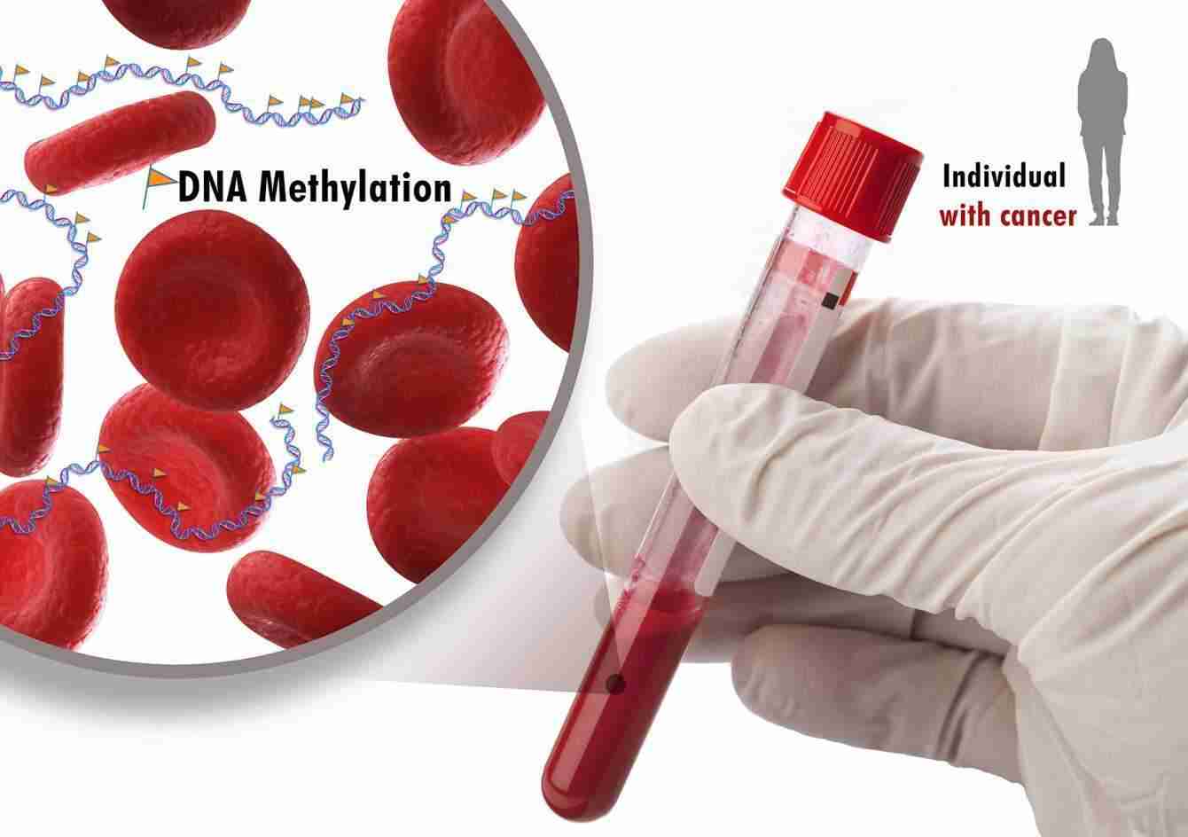 Tumori: un nuovo test del sangue ne rileva 50 | Medicina