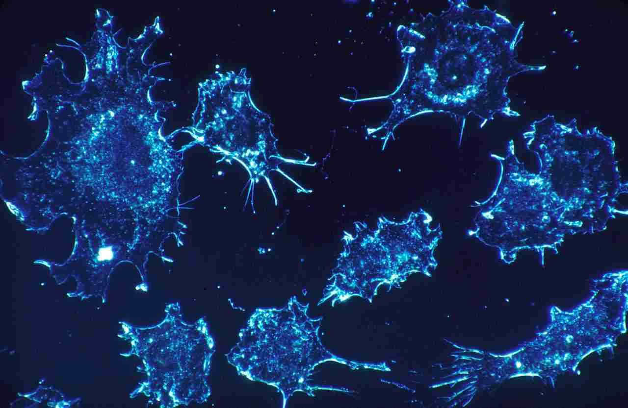 Tumori: un nuovo test del sangue ne rileva 50 | Medicina
