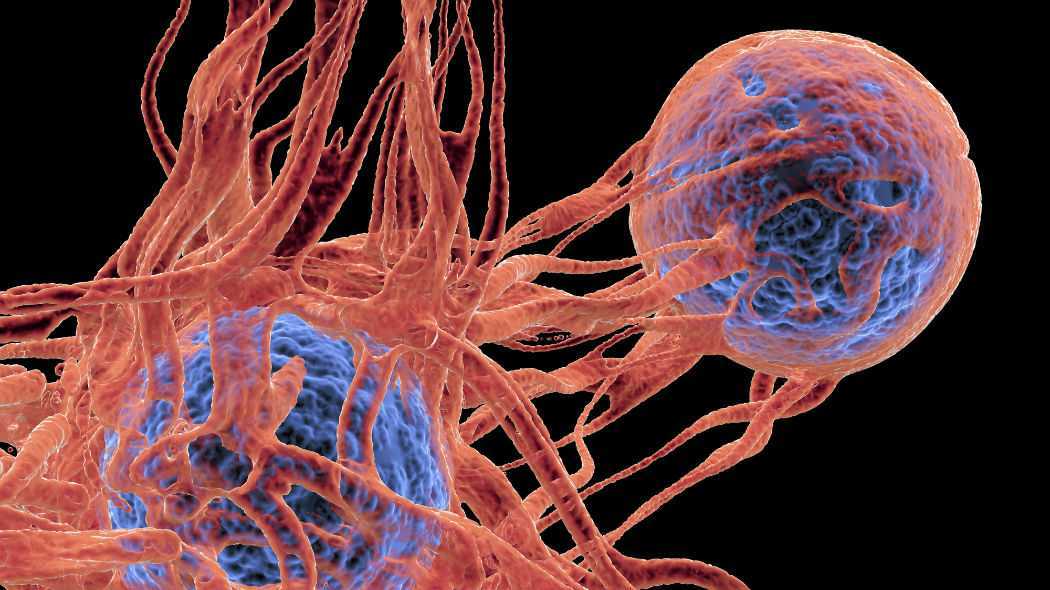 Tumori: rischio di sviluppare metastasi scritto nel Dna | Biologia