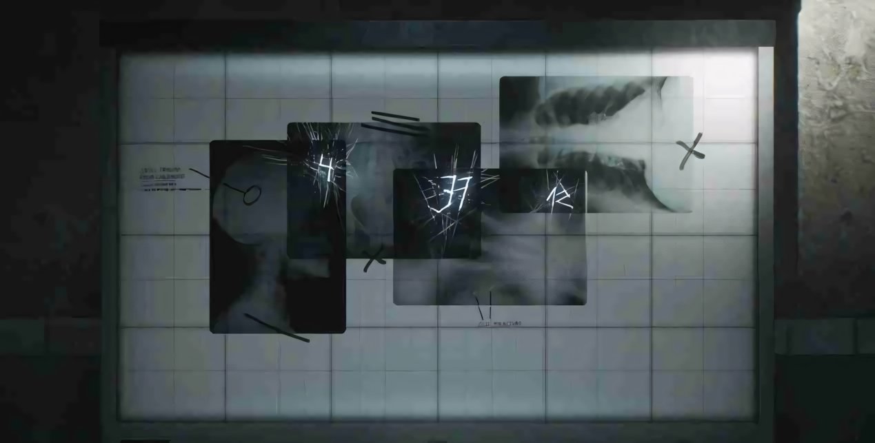 Silent Hill 2 Remake: soluzione all'enigma delle lastre a raggi X